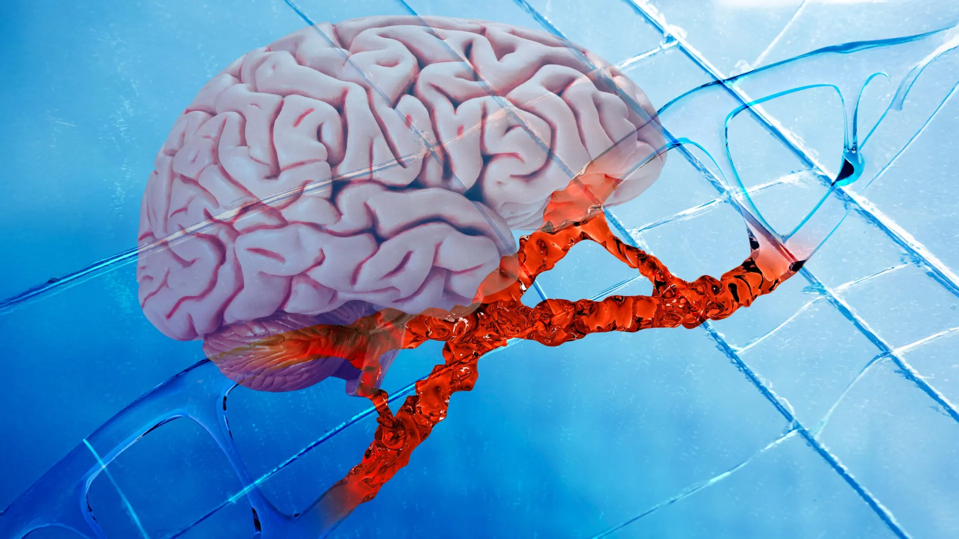 New Alzheimer's drug repairs DNA damage and reduces brain inflammation - ScienceDaily